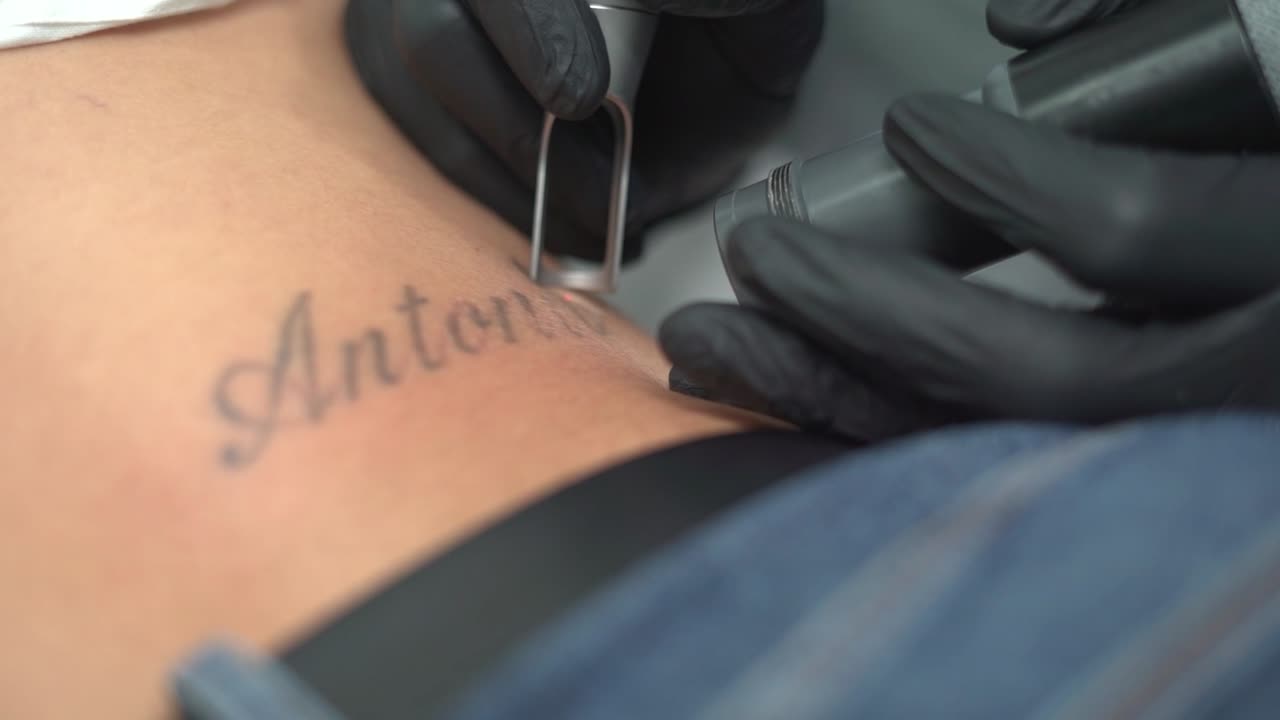 quitar el tatuaje de la mujer, borrarlo o borrarlo
