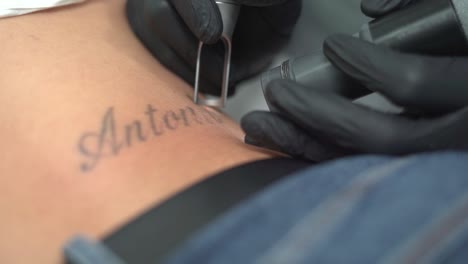 Frau-Entfernen-Tattoo,-Löschen-Oder-Löschen