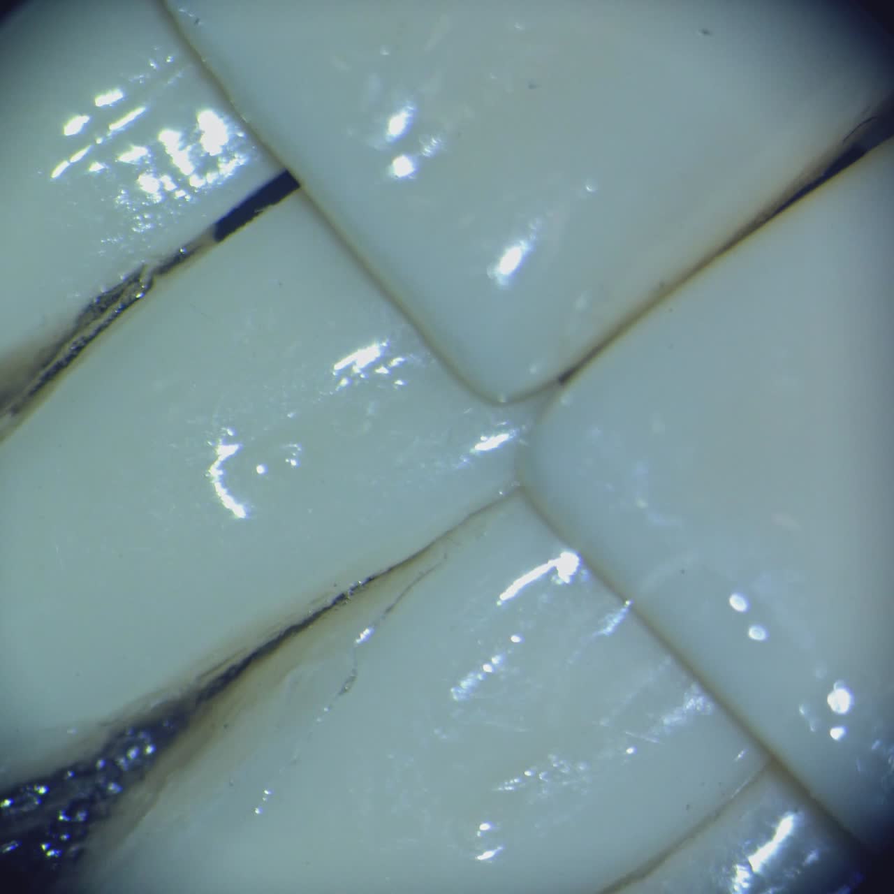 Macro shot of teeth. Circle view from microscope of patient's teeth. Close-up.
