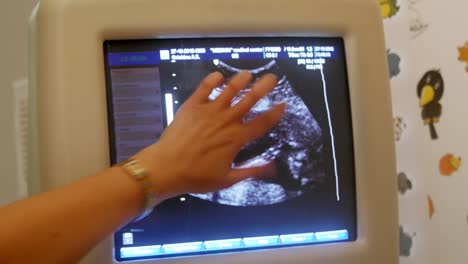 fetal ultrasound scan