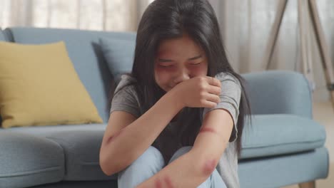 close up of young asian woman victim of violence with bruise on body crying being hurt from physically abused while sitting on the floor at home