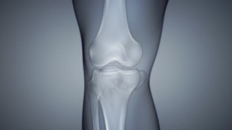 view an x-ray showing the intricate details of a knee joint during a medical assessment. this visual helps in understanding potential injuries or conditions affecting mobility.