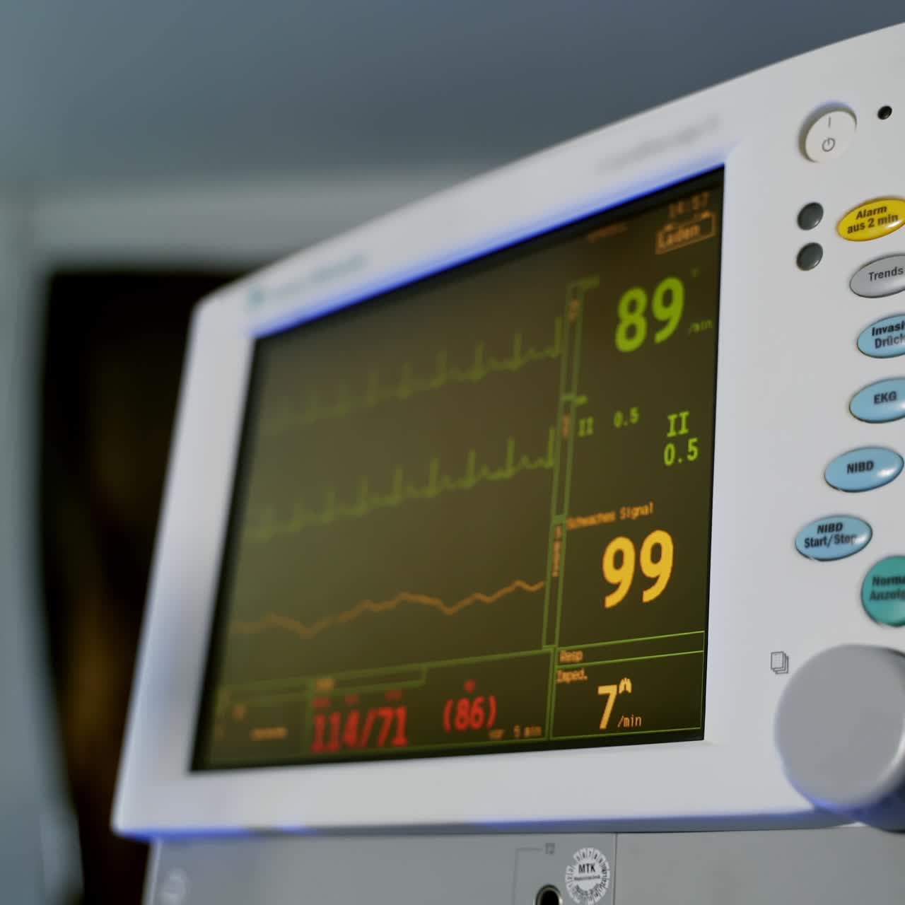 Diagrams of ECG screen. Electrocardiograph machine displays graphics of electrical activity of patient heart beat and blood pressure during surgery in operating room.