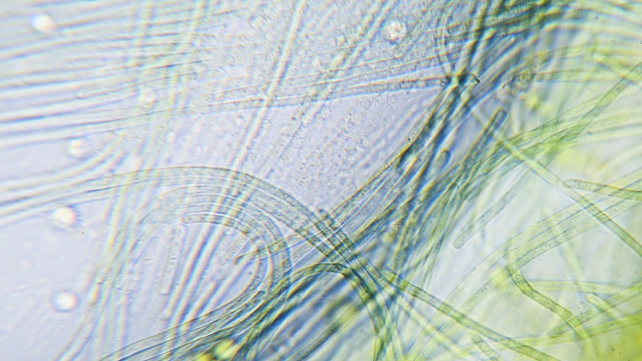 현미경으로 시아노박테리아와 녹조류의 움직임