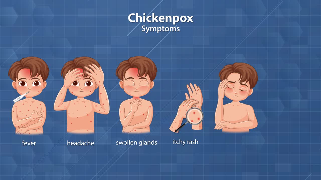 Animated sequence illustrating chickenpox symptoms in a boy, with labeled icons and smooth transitions