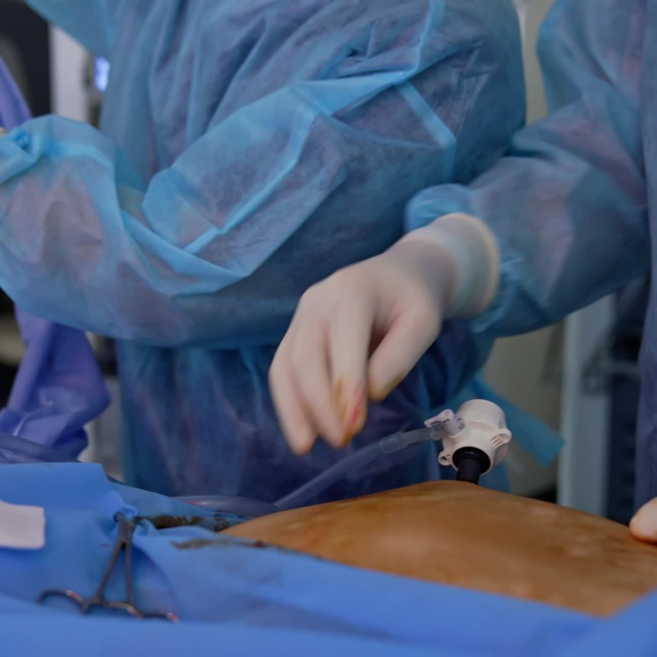 Close up of operation in theater. Team of doctors working together during surgery in operating room