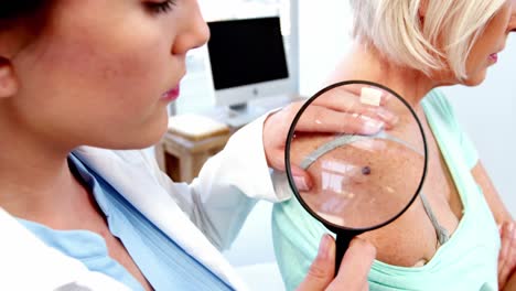 dermatologist examining mole with magnifying glass