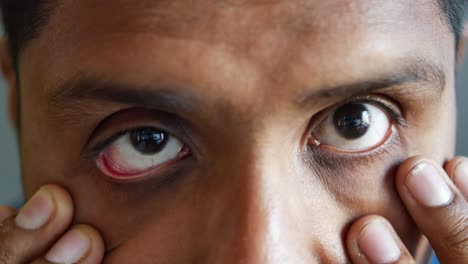 close-up of a man with tired eyes and dark circles