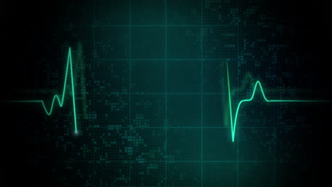 ecg electrocardiogram