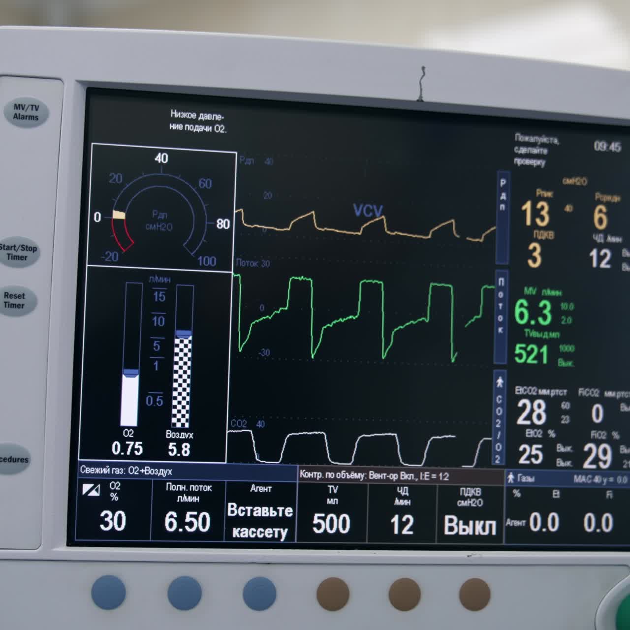 Various life parameters on the black screen of lung ventilation system. Equipment working in the operational room during procedure