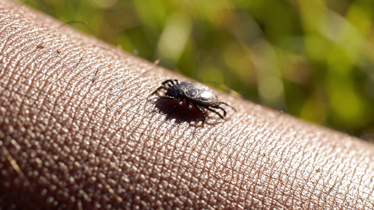 Observación de cerca de una garrapata hinchada en la piel humana: Comprendiendo las implicaciones de las picaduras de garrapata y los riesgos involucrados en la transmisión de la enfermedad de Lyme.