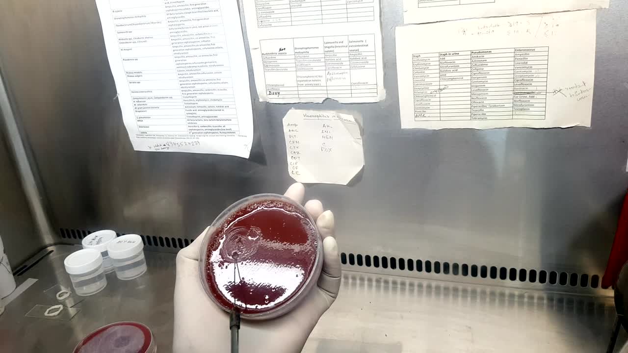 inoculación de bacterias en una placa de cultivo con un bucle utilizando la mano con guantes por un científico