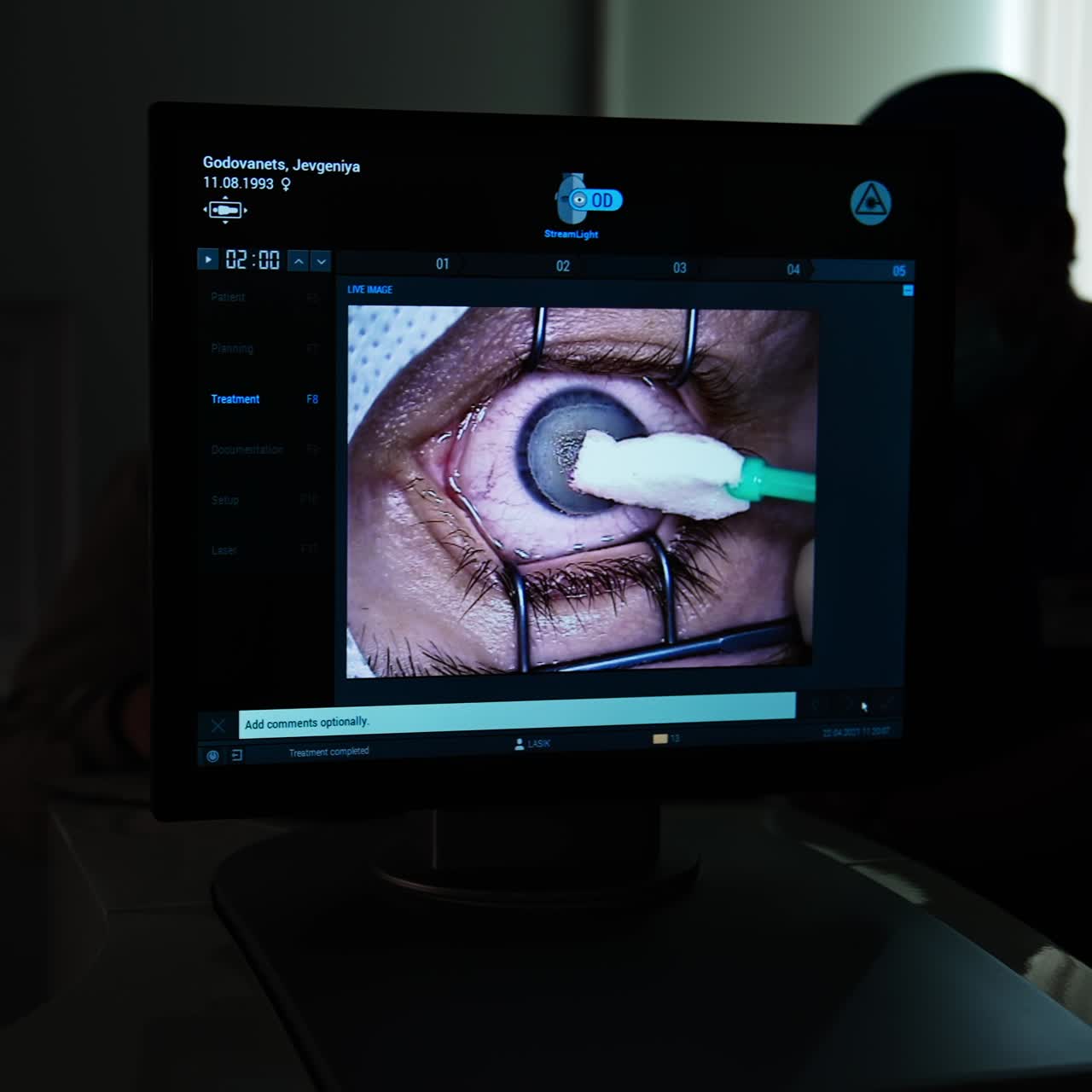 Professional laser eye correction. Microscope professional eyesight operating