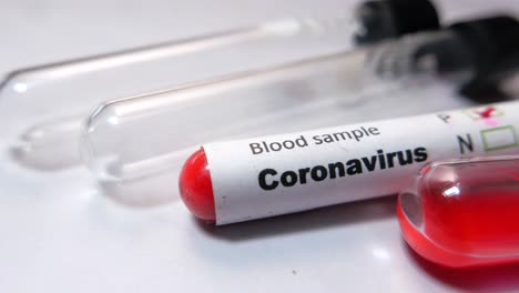 coronavirus blood sample test tubes