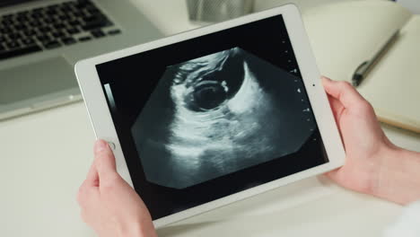 ultrasound scan on tablet
