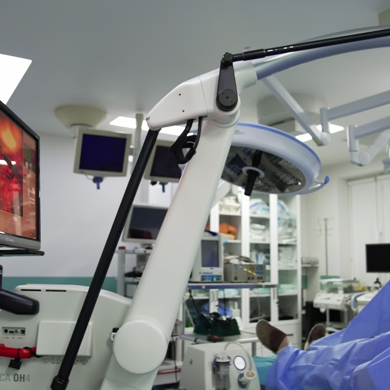 Laparoscopic operation performed with advanced gadgets shown at the screen. Team of doctors conducting operation in modern hospital