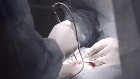 surgical procedure