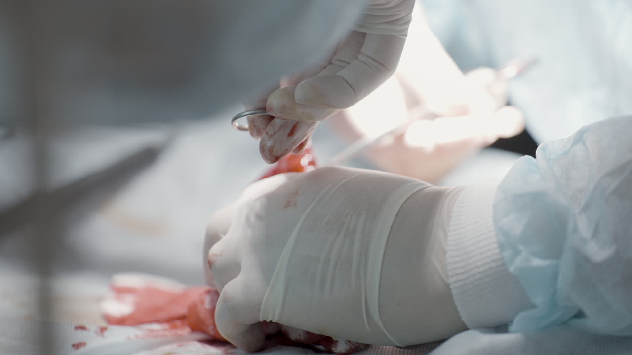 Surgical Procedure