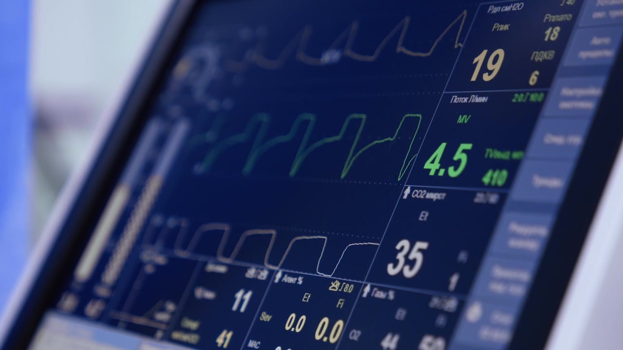 Linee curve e figure dei segni vitali sul monitor. Primo piano dello schermo scuro di apparecchiature mediche.