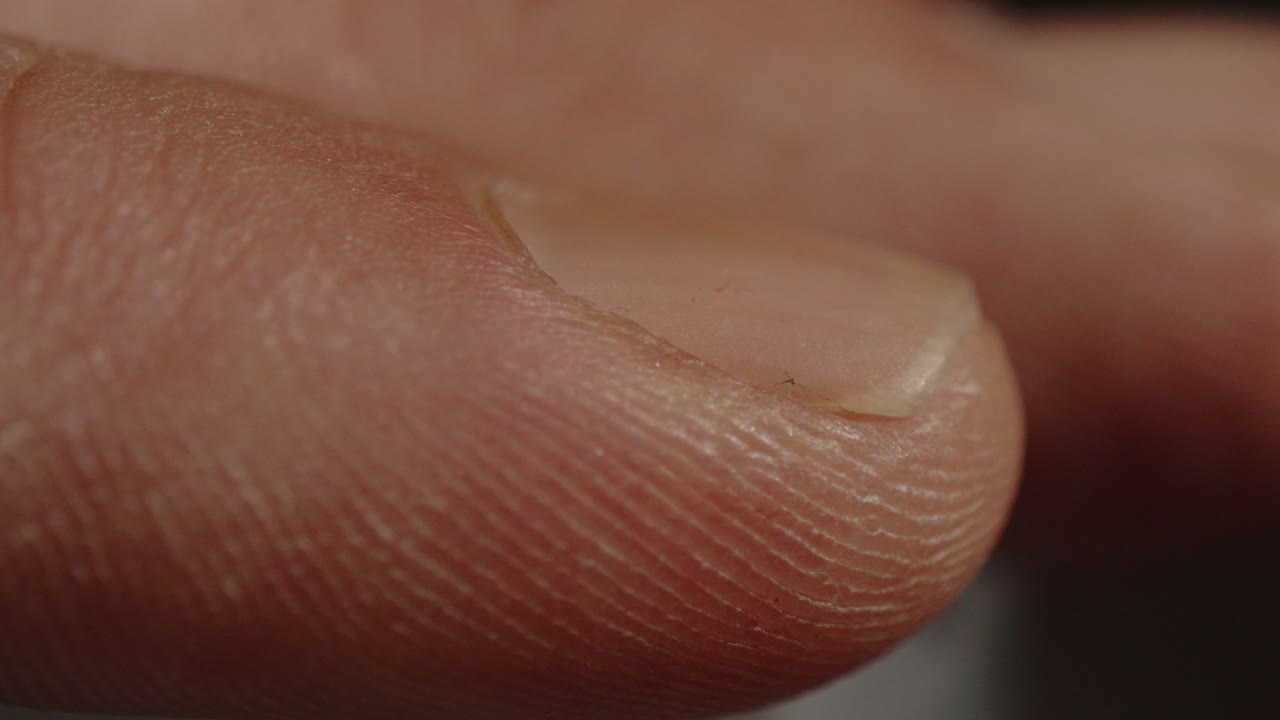 Macro Close up of discolored man's fingernail on index finger