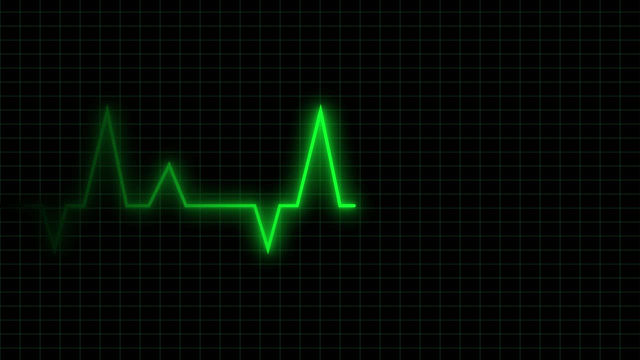 Linea verde del battito cardiaco pulsante su monitor a griglia nera