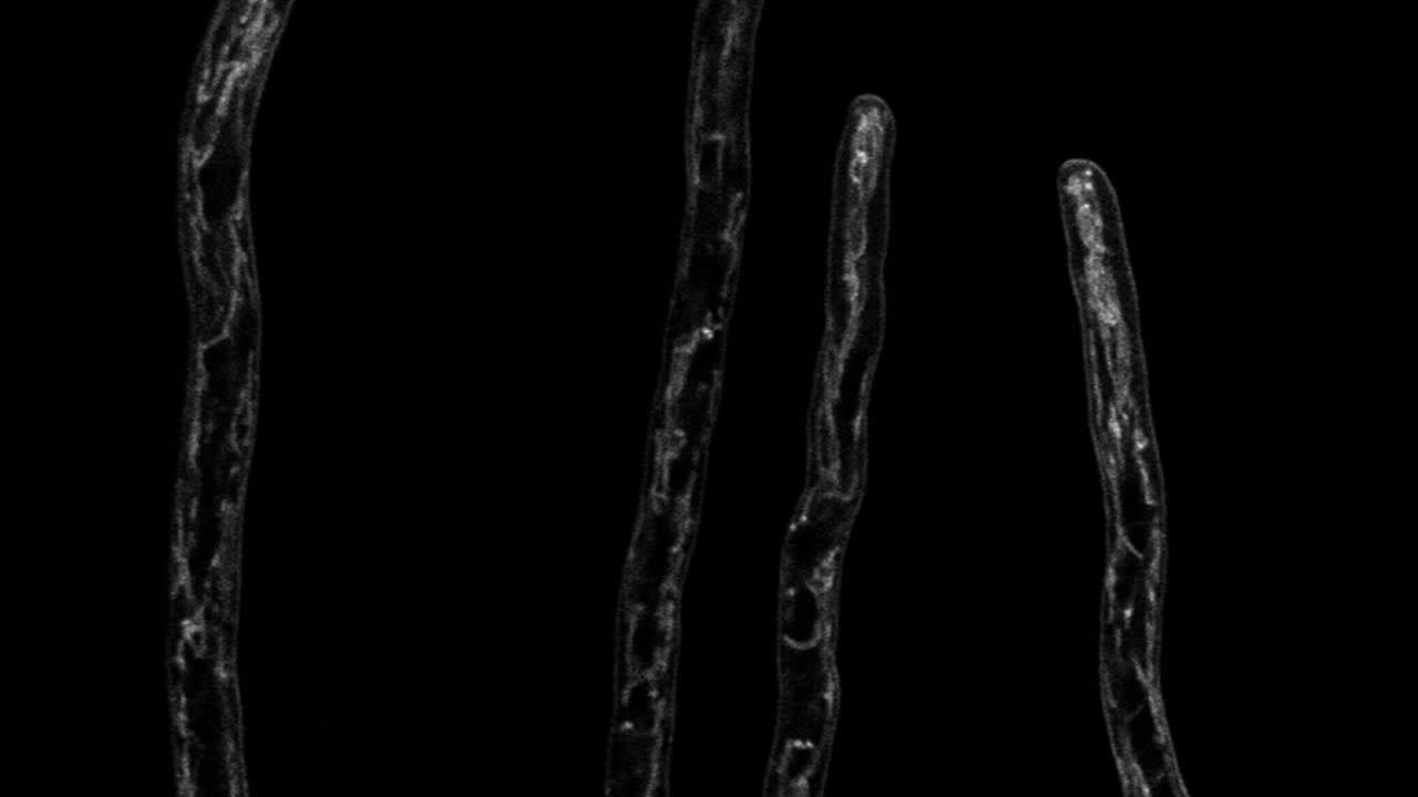 꾸준히 위쪽으로 성장하는 균사의 시간 경과