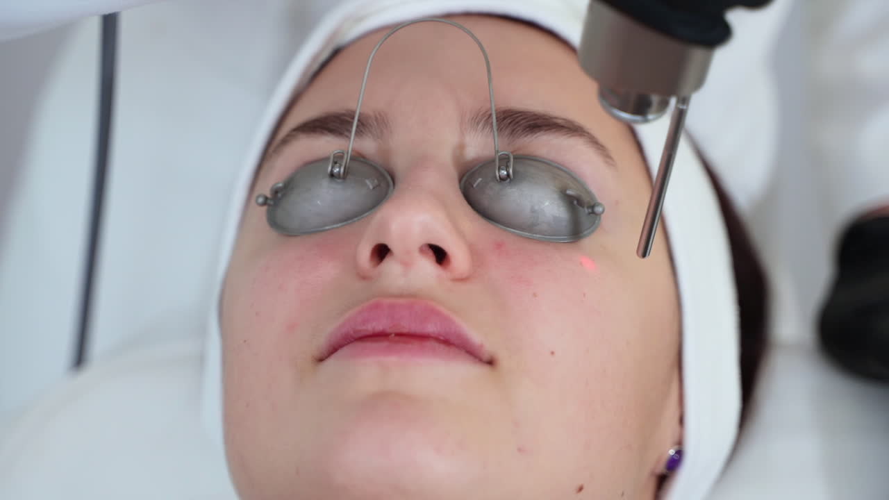 레이저 피부 치료