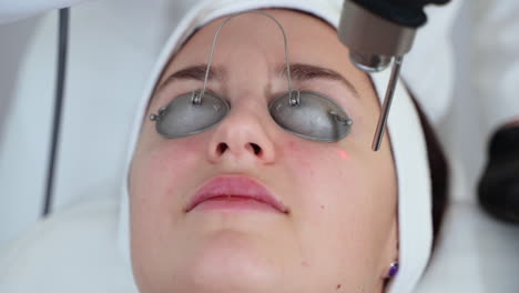 laser skin treatment