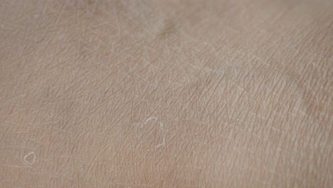 close-up of dry skin