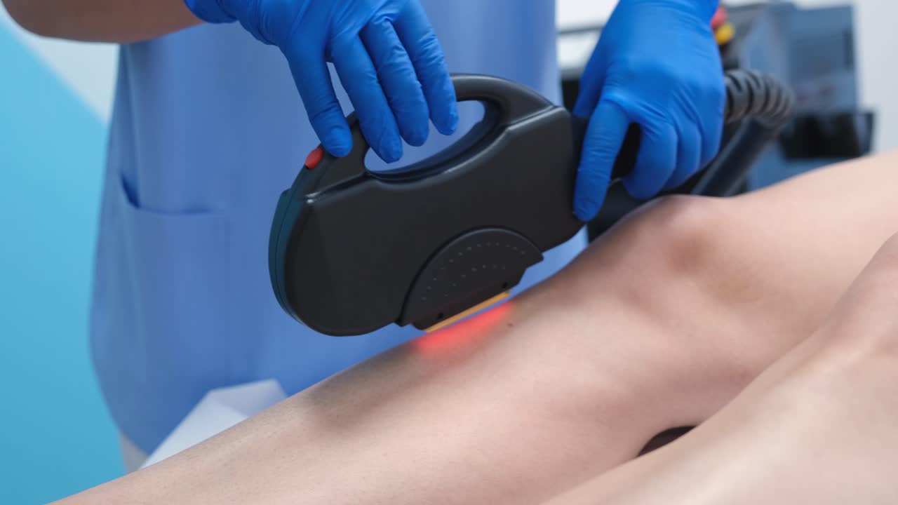 Laser Hair Removal Treatment