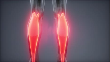 gastrocnemius- visible muscle anatomy map