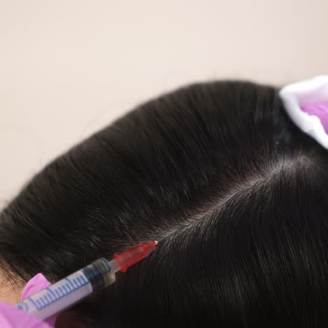 handsome woman receives an injection in the head. the concept of mesotherapy. thrust to strengthen the hair and their growth