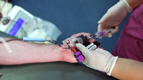 plastic bag of iv drip is filled with donor's blood. gloved hands of unrecognized medic fill the test tubes with blood samples. close up.