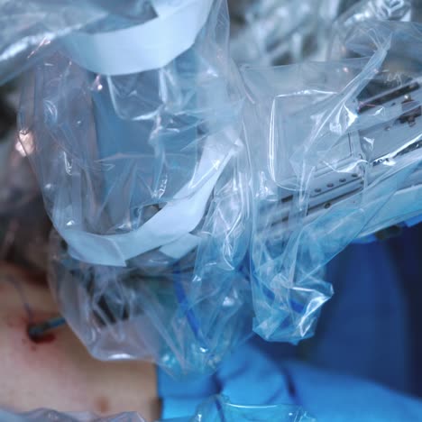 medical operation involving robot. medical robot. robotic surgery.
