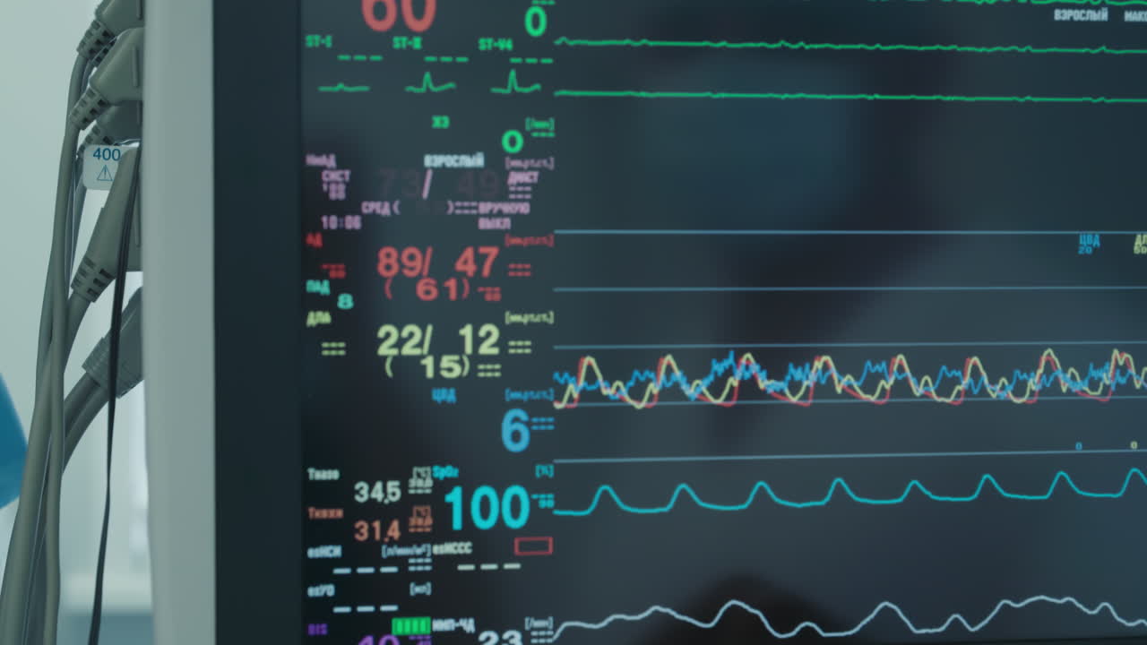 모니터는 환자의 생명 신호를 표시합니다. 수술실에서 안전한 상태를 보장하기 위해 환자의 건강을 지속적으로 모니터링하는 현대적인 장비