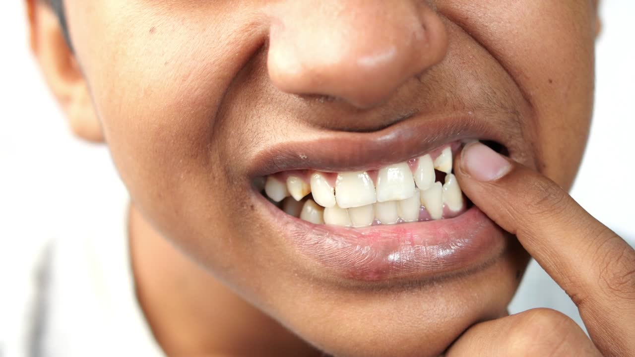 치아가 민감한 십대 소년