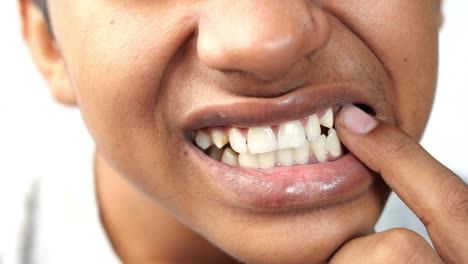 muchacho adolescente con dientes sensibles ,