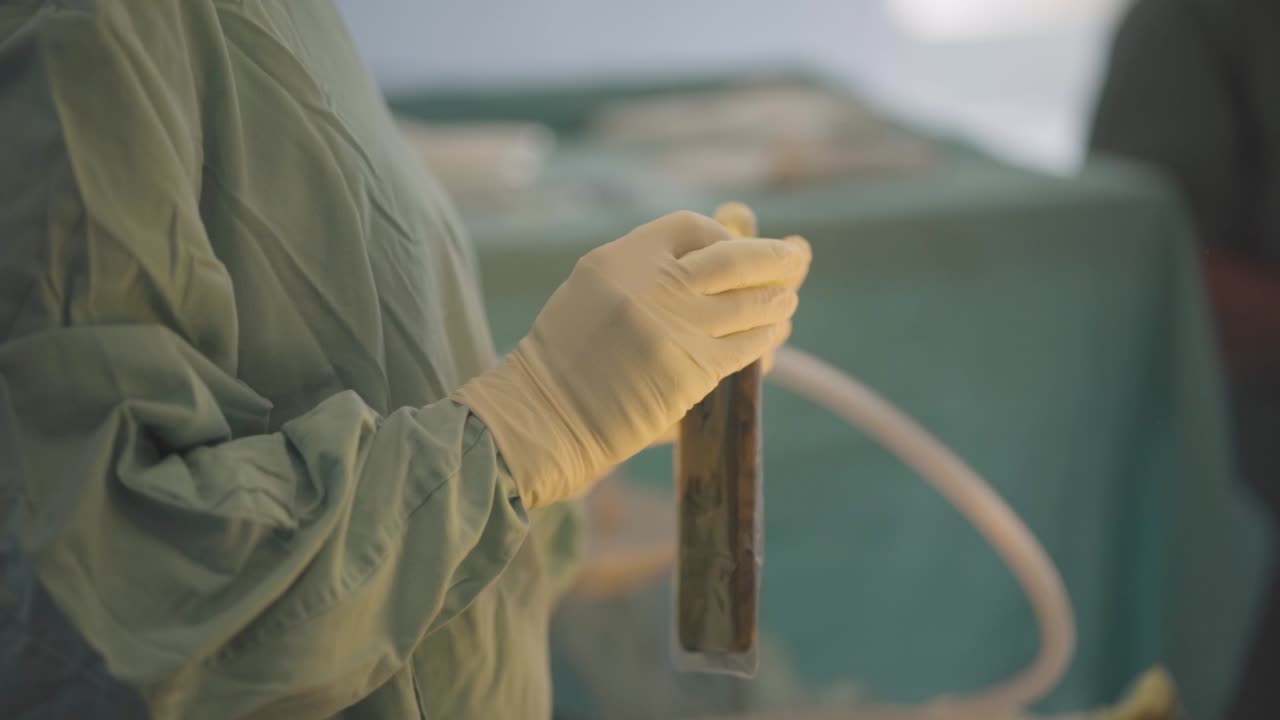 미용 수술에서 사용되는 장비를 조작하는 간호사, 의료 환경에서 정밀함과 주의를 보여주는