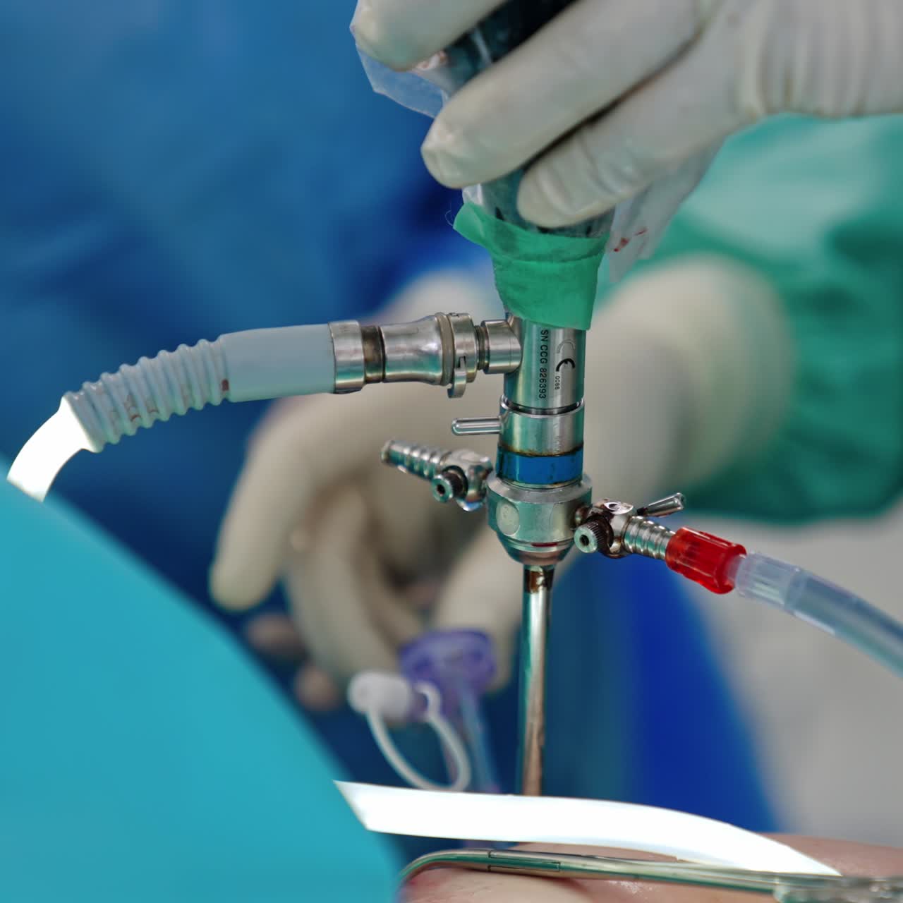 Gloved doctor's hands hold laparoscopic tool. Close up. Assisting surgeon removes the instrument from the patient's body