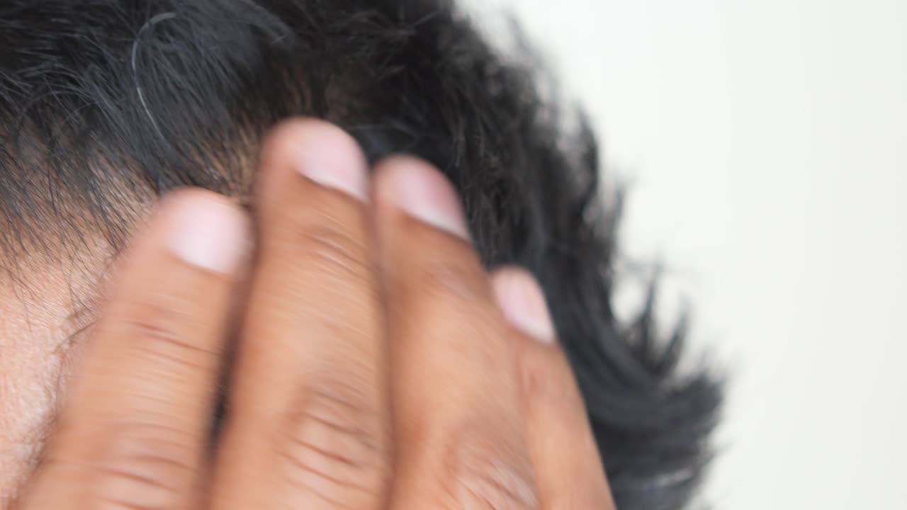 머리카락의 탈모의 클로즈업