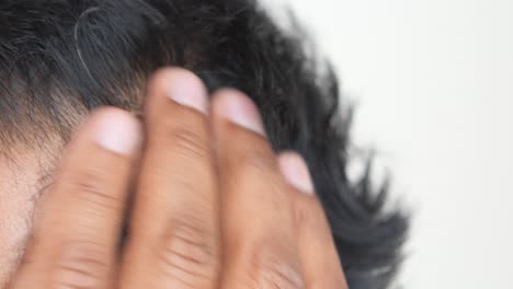primer plano de la pérdida de cabello en el cuero cabelludo