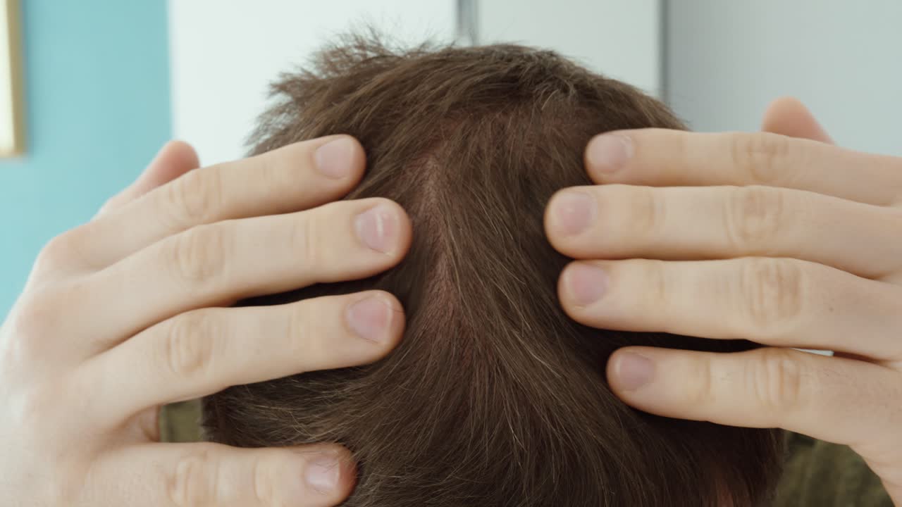Close-up of a man parting his hair to inspect the scalp, highlighting concerns about dandruff, lice infestation, itching, and personal hygiene at home
