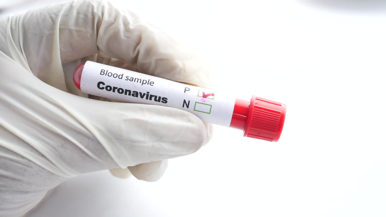 prueba de muestra de sangre de coronavirus