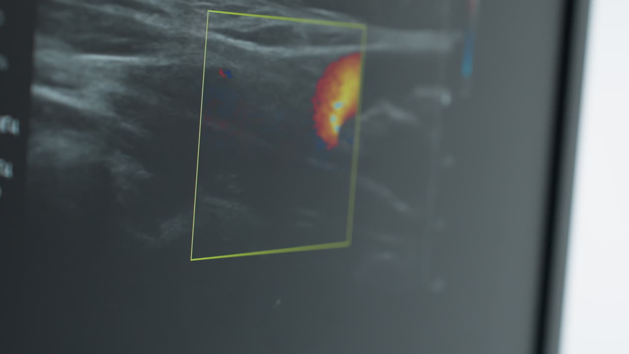 Close up of MRI imaging screen displaying vibrant scan area with dynamic movements, showing internal body activity during medical examination with emphasis on color coded diagnostic visualization