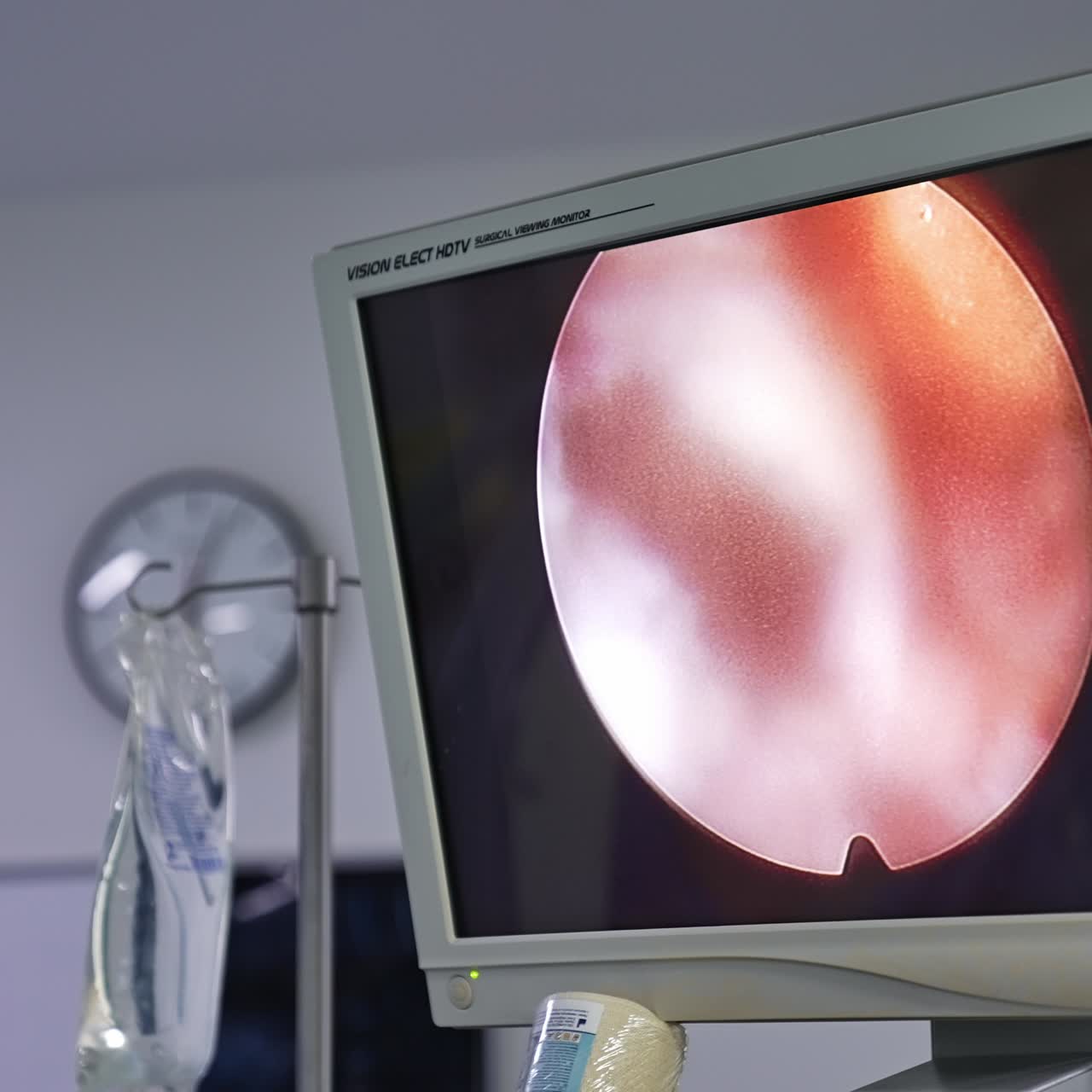 Schermo acceso che funziona nella sala operatoria. Monitor che mostra il funzionamento di attrezzature avanzate. Primo piano