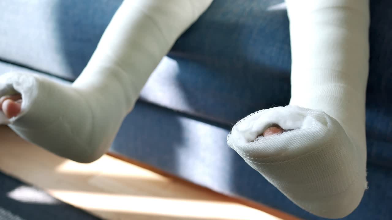 niño con una pierna rota en yeso