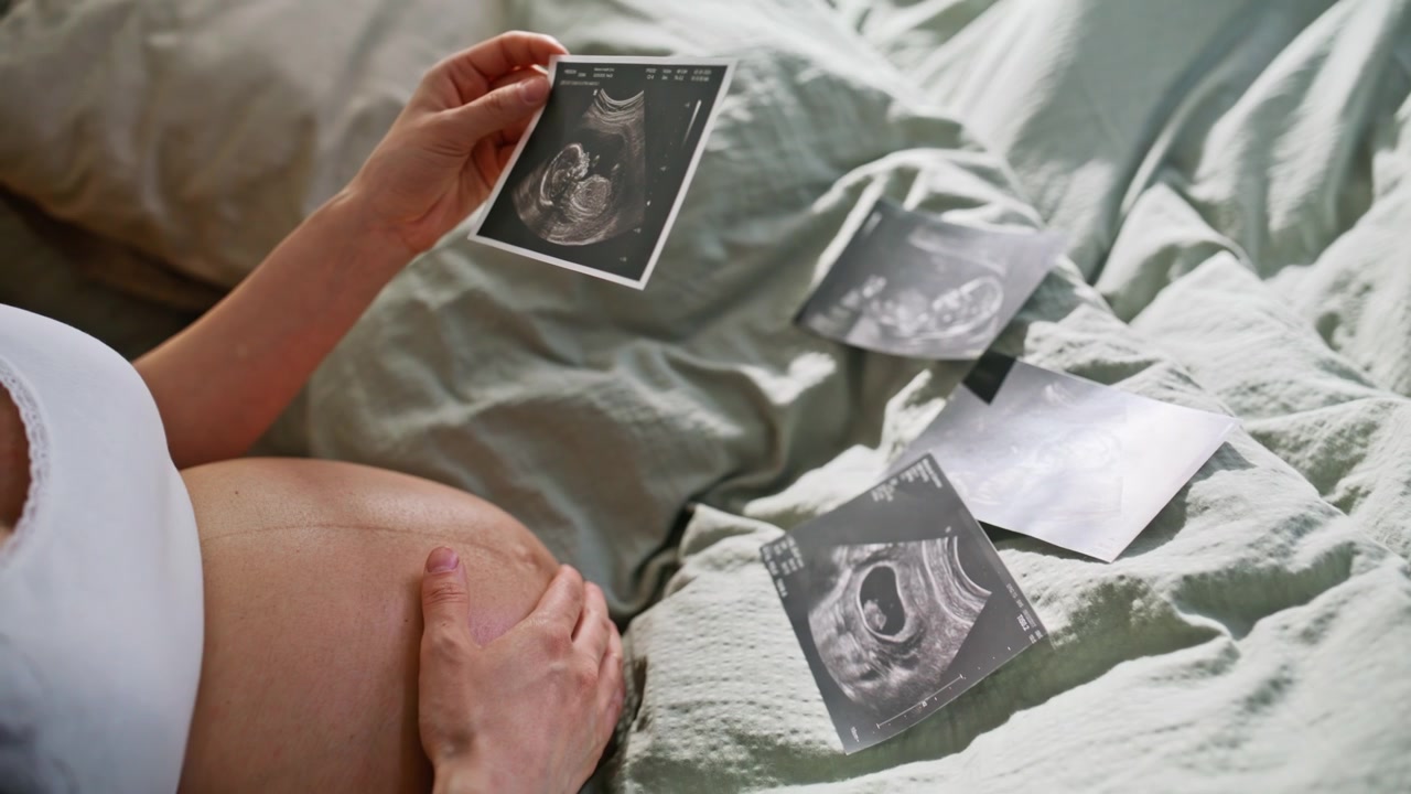 Close up sonogram photos pregnant belly. Woman holding ultrasound scan bed home.
