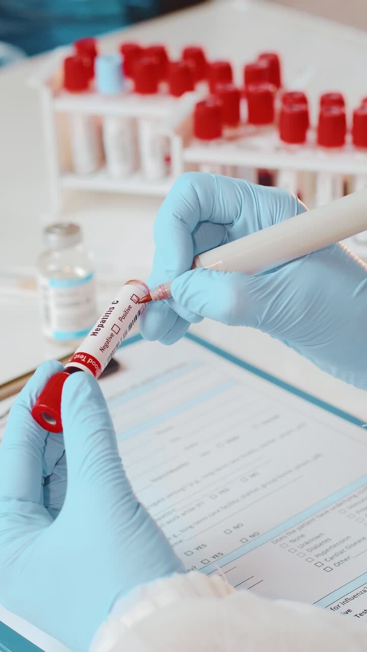 ヘパチチス c 血液検査