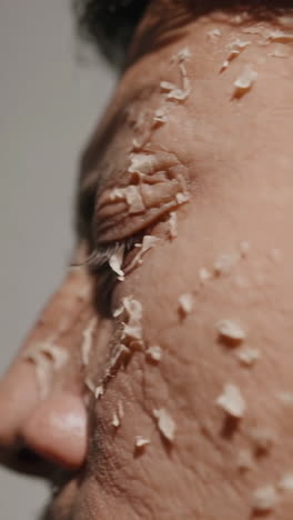 close-up of a man's face with dry, peeling skin