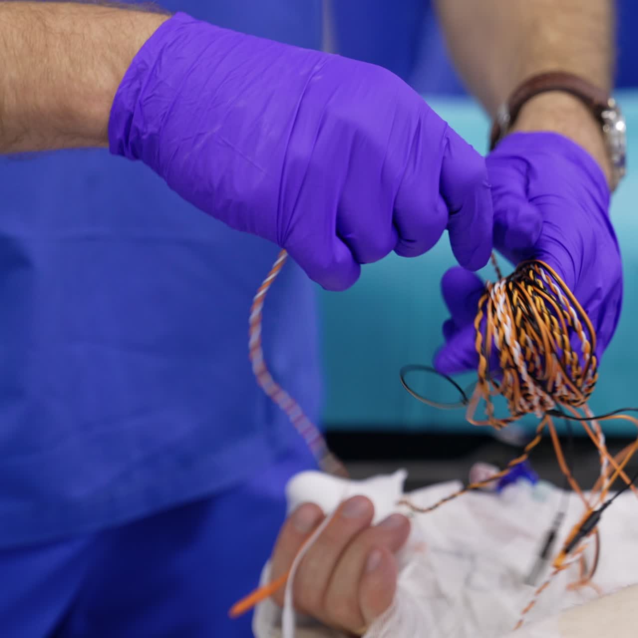 Mani maschili che indossano guanti in lattice blu che avvolgono un filo. Procedura di neuromonitoraggio in un moderno ospedale